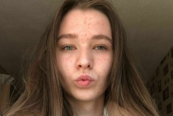 Emmi-Hill